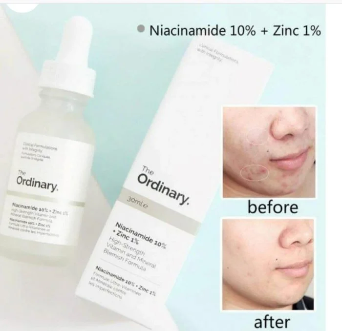 سرم ضد جوش و روشن کننده نیاسینامید 10% + زینک 1% اوردینری